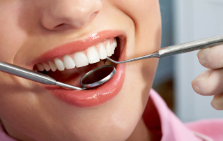 Important Facts About Wisdom Teeth