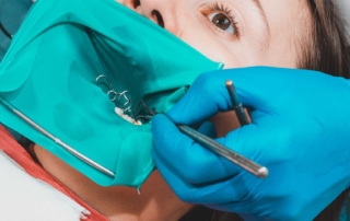 Reasons to Consider a Composite Restoration