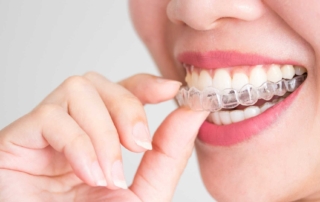 What to consider before getting Invisalign treatment?