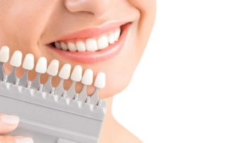 Getting a Dental Crown: What you need to know