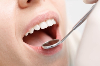 Tooth-Coloured Fillings: The Aesthetic Choice For A Healthier Smile Kitchener Dentist Sherwood Dental